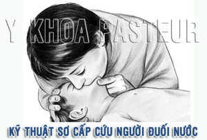 kỹ thuật sơ cứu người đuối nước