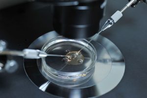 Tìm hiểu những kỹ thuật hỗ trợ sinh sản hiện đại ngày nay (p1)